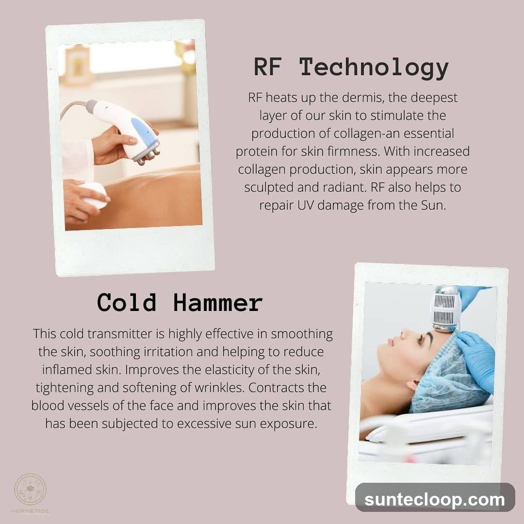 RF Technology and Cold Hammer Treatments