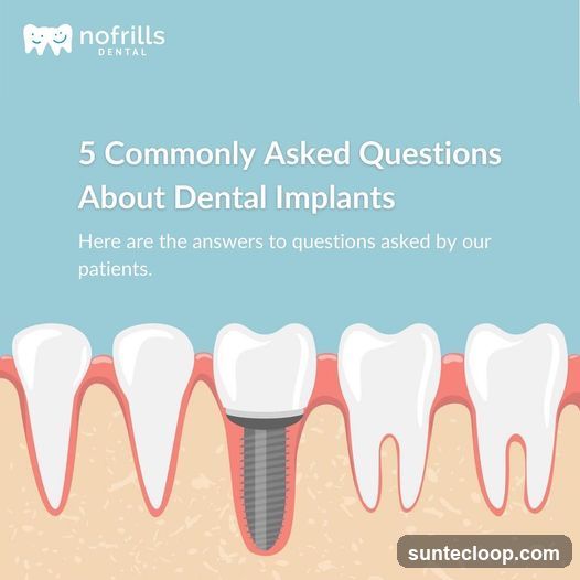5 Commonly Asked Questions About Dental Implants