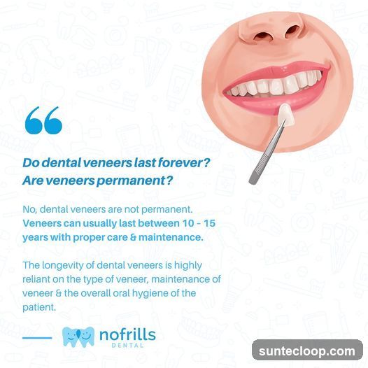 Dental Veneer Longevity