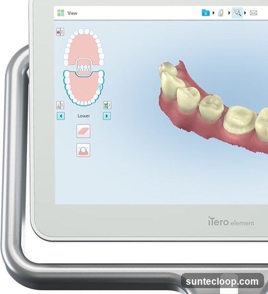 iTero Element Dental Scanner