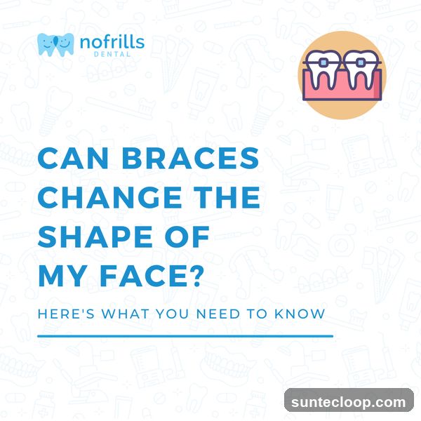 Can Braces Change The Shape Of My Face?
