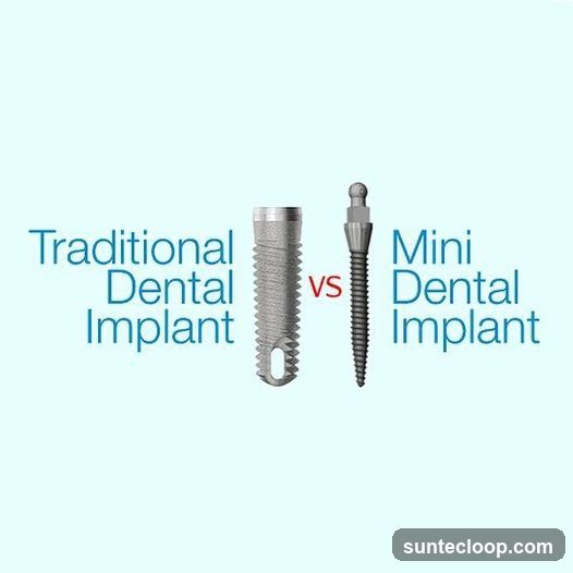Traditional vs. Mini Dental Implant